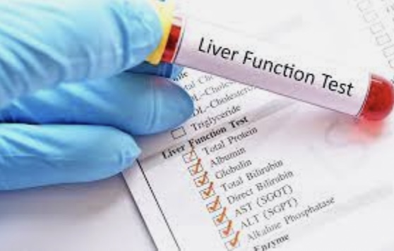 What are things to look for in a liver function blood test?